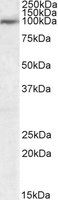 USP20/VDU2 Antibody