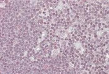 NIPP1/PPP1R8 Antibody