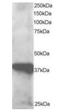 Goat anti-GIPC3 Antibody