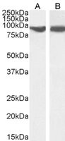 VPS35/MEM3 Antibody