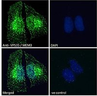 VPS35/MEM3 Antibody