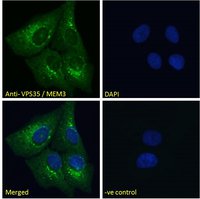 VPS35/MEM3 Antibody