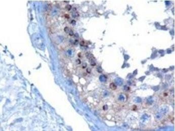 VPS28 Antibody