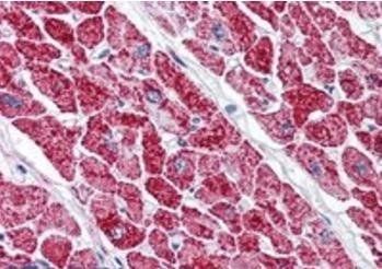 VDAC2 (C Terminus) Antibody