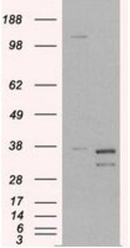 Pirin Antibody