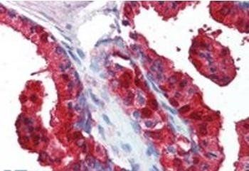Sorbitol Dehydrogenase Antibody