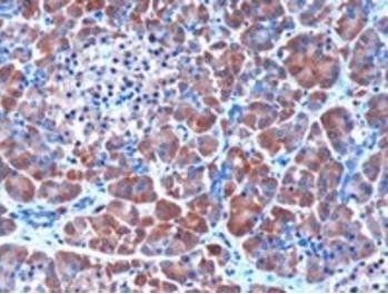 MEPI/SERPINI2 Antibody