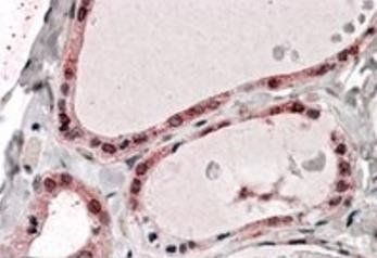 PP2A/PPP2R1A Antibody
