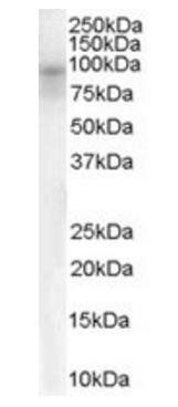 Dipeptidylpeptidase 10 Antibody