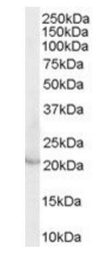 Goat anti-Lipocalin 2 / NGAL Antibody