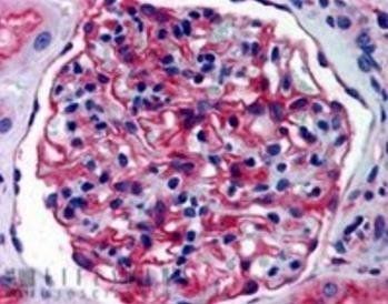 Aminopeptidase A Antibody