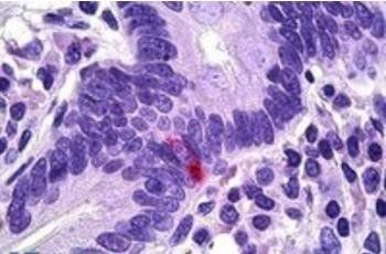 Pancreatic Polypeptide/PPY Antibody