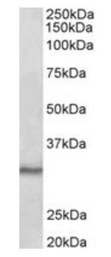 CTDSP1 Antibody