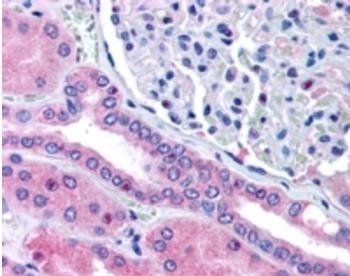 Rhophilin 2 (Internal) Antibody