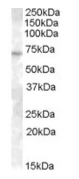 ABCE1/ RNAse L inhibitor Antibody