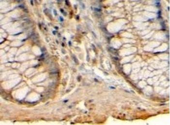 Histamine Receptor H1 (C Term) Antibody
