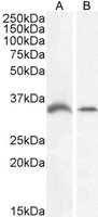 Goat anti-GDF15 Antibody