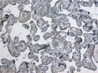 Goat anti-GDF15 Antibody