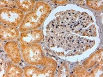 Goat anti-Adenosine A2b Receptor Antibody