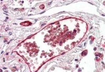 Goat anti-Duffy / FY / DARC Antibody