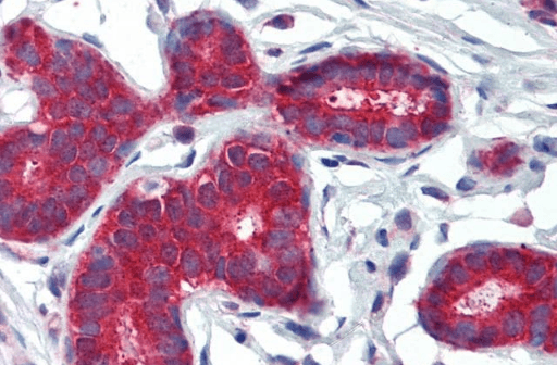 PTCH (C Terminus) Antibody