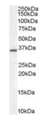 Rabring 7/BCA2 Antibody