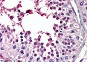 PIAS2 Antibody