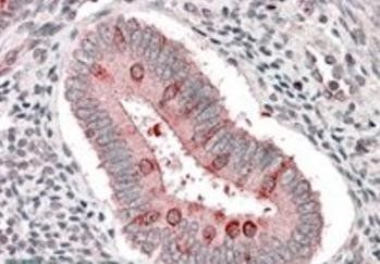 Hamartin/TSC1 (isoform 1) Antibody