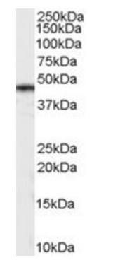 Casein Kinase 1, delta Antibody