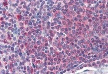 Catalase/CAT Antibody