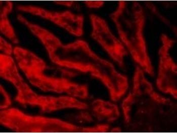 Glutathione Peroxidase 1 (isoform1) Antibody