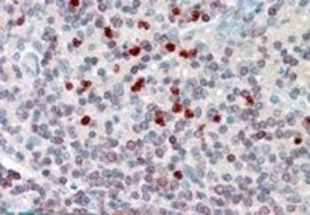 FLAP/ALOX5AP (internal) Antibody