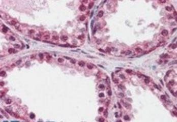 FOXP2 (internal) Antibody