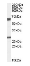 GPSM2 Antibody