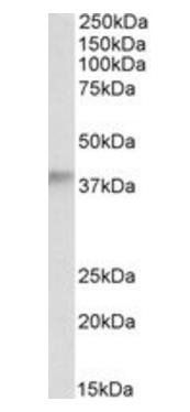 ADH5 Antibody