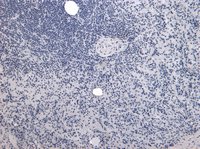 P4HA1 Antibody