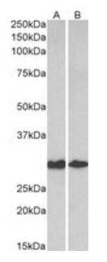 Galectin 3 Antibody