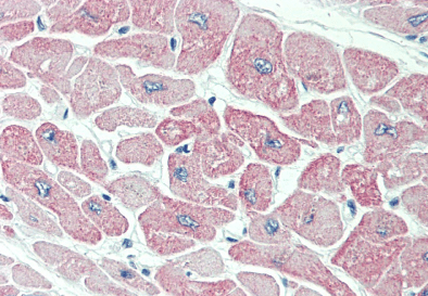 CLIC4 Antibody