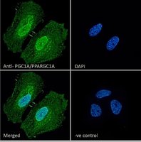 PGC1A/PPARGC1A Antibody