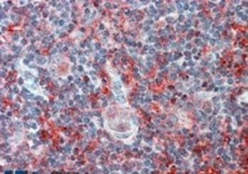 CADM4 (internal) Antibody