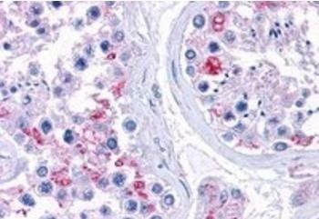 Ribosomal protein L22 Antibody