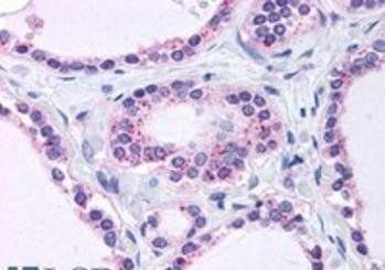 Ribosomal protein L22 Antibody