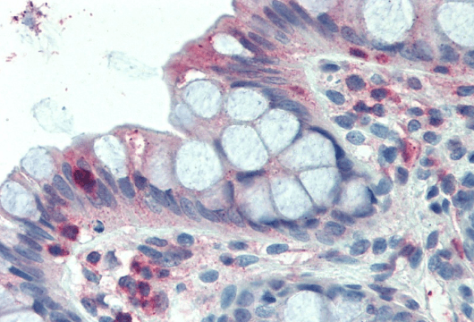 LASP1 (internal region) Antibody