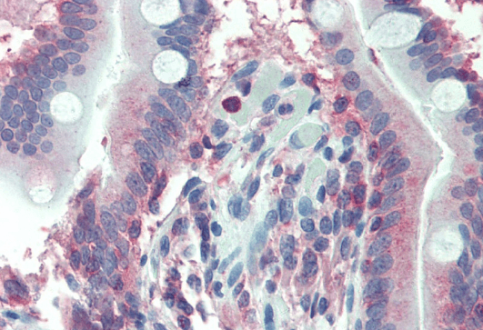 LASP1 (internal region) Antibody