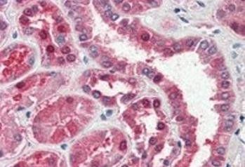 GOT1 (aa 157-167) Antibody
