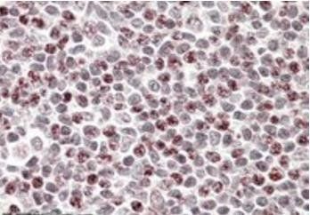 Goat anti-Phorbolin 1 / APOBEC3A Antibody