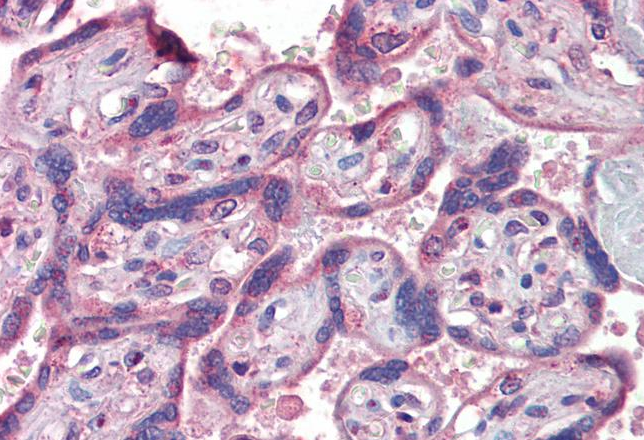 Goat anti-IFNAR2 Antibody