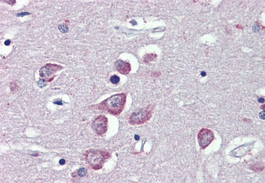 TRPM2 Antibody