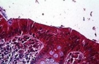 LRP4/LRP10 Antibody