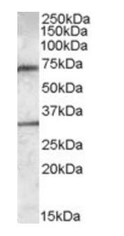 Goat anti-Endothelial lipase Antibody